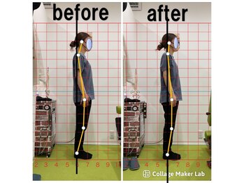 上本町骨盤整体院グッド/「整体による姿勢の変化」