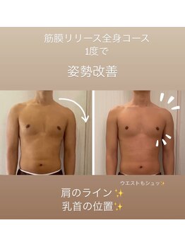 トラ 恵比寿店(TORA)/左右の歪み改善/バストケア