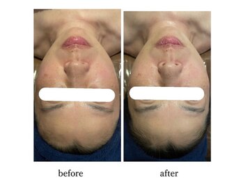 サロンドシェリ(salon de cheri)/小顔