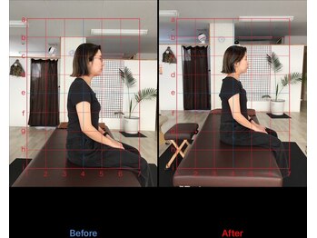 ストレチックス 近江八幡店/before/after