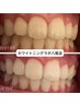 【当店人気No.2★】《初回お試し》セルフホワイトニング　40分¥5000→¥2500