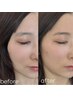 【学割U24】【眉毛アイブロウ】ハリウッドブロウリフトWAX脱毛