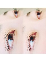 コア(Koa)/パリジェンヌリフト