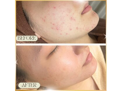 ノット(knote)の写真