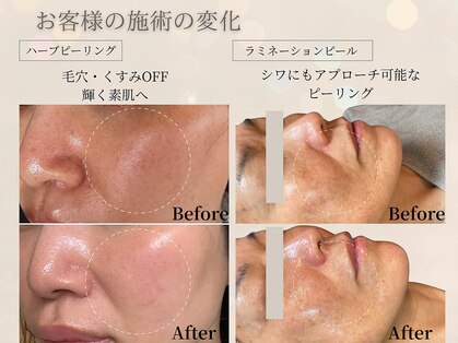 ヴィタベラ(Vita Bella)の写真