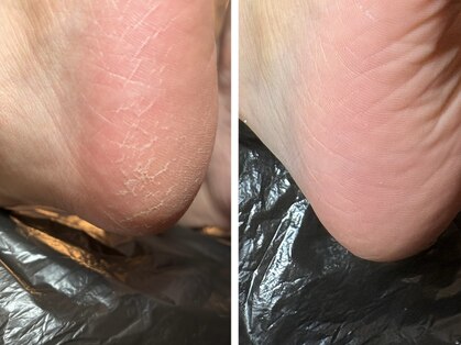 オリジン(Origin)の写真