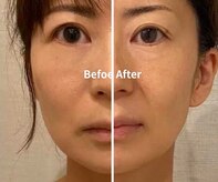 クリアボーテ プリュス(Clear Beaute Plus)