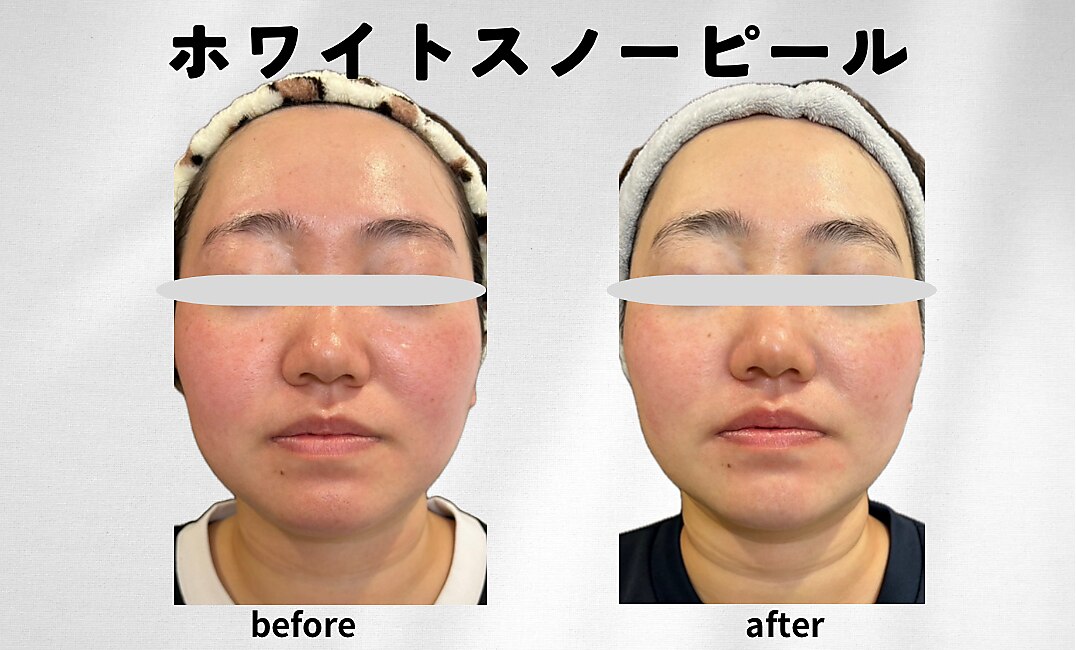 エレナ(Elena)｜ホットペッパービューティー