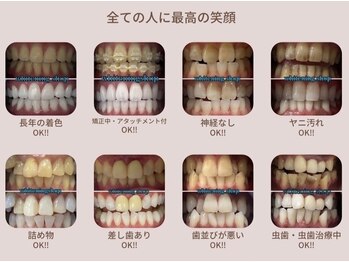 ホワイトニングショップ 池田店/【ヤニ、着色汚れもスッキリ】