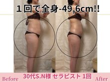 アメリイ 百合ヶ丘 新百合ヶ丘(Amerii)/【30代痩身】1回全身-49.6cm痩せ