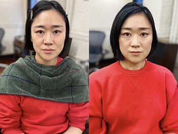 アトリエ スタンズ(atelierSTAENS)/30代の方ビフォー＆アフター