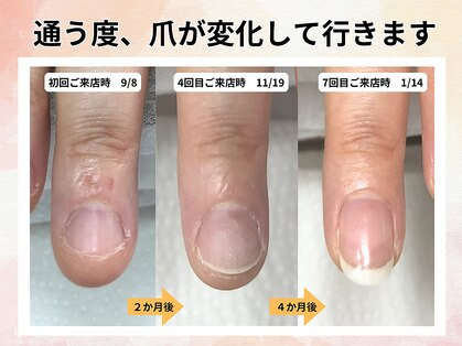 エルナの写真
