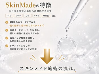 エイル(EILE)/SkinMade(スキンメイド)の特徴