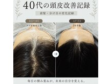 Virgowl はりまや町店【ヴァルゴール】の雰囲気(結果重視×癒し空間で本格的ケア毛穴/水光ジェット/ヘッドスパ)
