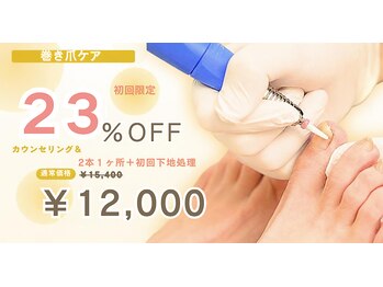 小田急相模原巻き爪センターの写真/【初回限定クーポン】カウンセリング&2本・1か所ずつ+下地処理¥15400→¥12000