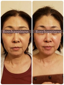 ロージーハピネス(Rosy happiness)/全体的に若い印象に