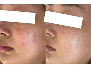 ラポール 野並店(Rapport)/