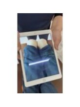 施術前の歪みの状態を画像でご本人に確認していただきます。