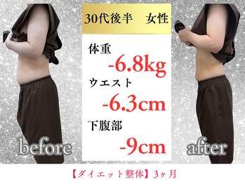 ボディメイク アールエフ サクラ接骨院(bodymake RF SAKURA接骨院)/30代　3ヶ月で下腹部ー9cm