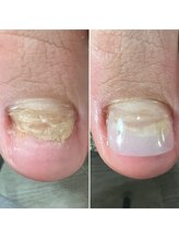 ルーチェ バイ フェリシア(LUCE by Felicia)/こんなお爪もお任せください☆