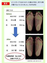 中央治療院/専用の機器で測った足型画像