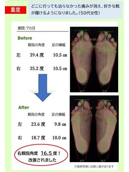 中央治療院/専用の機器で測った足型画像