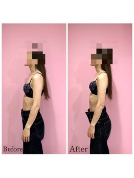 ククナ 長岡西店(KUKUNA)の写真/《男性も施術OK♪》姿勢改善で周りの人に差をつけよう☆男性のお客様も大歓迎☆お気軽にお越しください!!