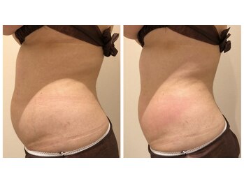 エイシスグロウ(asis glow.)/効果写真