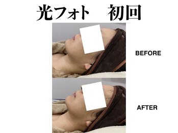 ティアム バイ テトテ 神戸三宮(TIAM by tetote)/光フォト