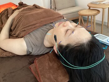 ハリファ鍼灸院 横浜関内院(HariFa鍼灸院)/美容施術