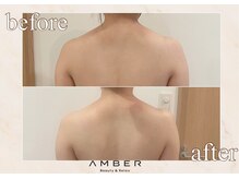 アンバー 恵比寿(AMBER)/ブライダル前に大人気