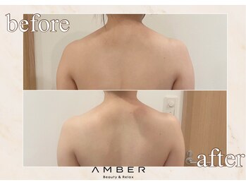 アンバー 恵比寿(AMBER)/ブライダル前に大人気