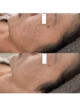 ヴェルシック(Belchic)/自分史上最高の素肌へ