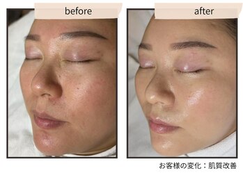 コンビンス(convince)の写真/【素肌に自信】表面的なケアは卒業！ハイブリッド肌育で、内側から発光するような透明感と輝きを★