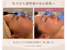 アンプリール(emplir)の雰囲気（小顔顔筋矯正・トラブル肌）