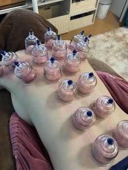 眠るひつじと深呼吸/吸い玉（カッピング）