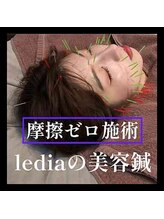 ルディア 堀江店(ledia)/摩擦は肌の大敵！だから美容鍼