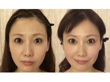 肌質改善ラボ【ハーブピーリング/ララピール/小顔矯正/骨盤矯正】