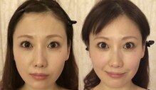 肌質改善ラボ【ハーブピーリング/ララピール/小顔矯正/骨盤矯正】