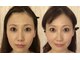 肌質改善ラボの写真