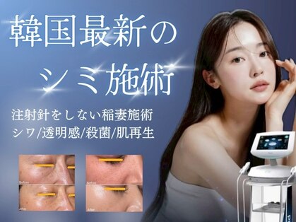 ウェリナ(Welina)の写真