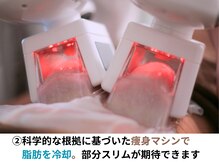 ボディネイト 京都四条烏丸店(Body Nate)/2.脂肪冷却