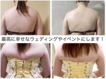 スリーピングビューティー(Sleeping Beauty)の雰囲気（ブライダルやイベントにも◎見せる背中作りもお任せください♪）