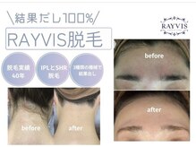 エステティック レイビス 池袋店(RAYVIS)