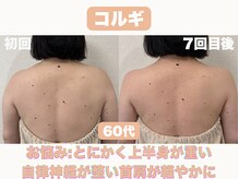 ナーナモエ(na-namoe)/上半身の疲れを一掃