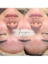 フリージア(Freesia)/毛穴の引き締まり方が◎