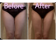 クリスタルビューティー/６回コース