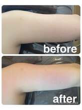 ギンザアール(GINZA R.)/二の腕にアプローチ！