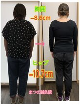 まつの鍼灸院/背中もお尻も小さくなりました