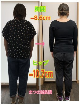 まつの鍼灸院/背中もお尻も小さくなりました
